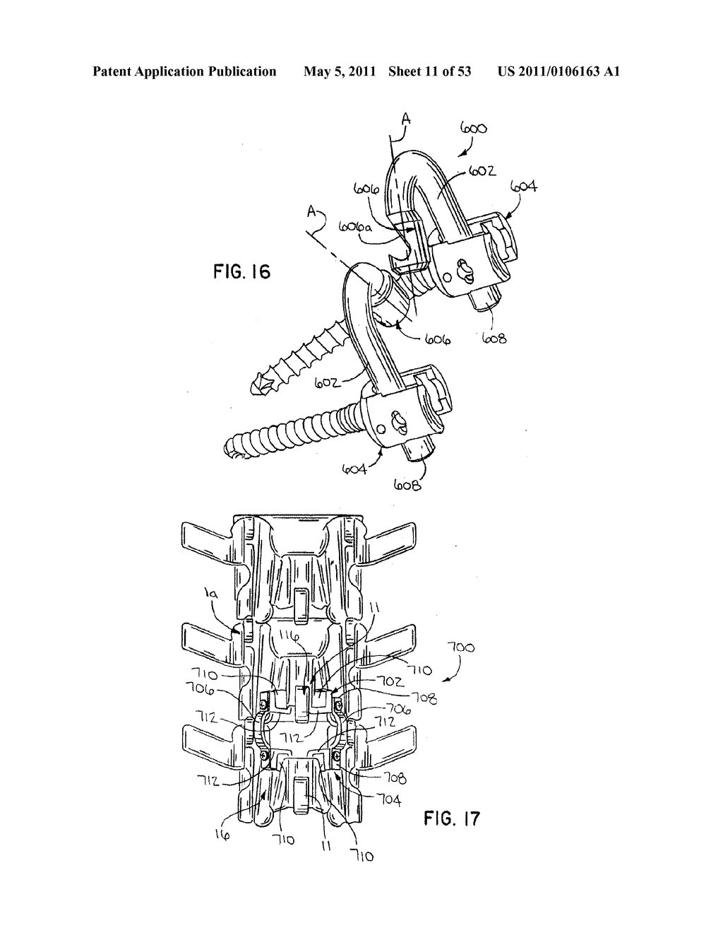 Interlaminar Stabilizing System - diagram, schematic, and image 12