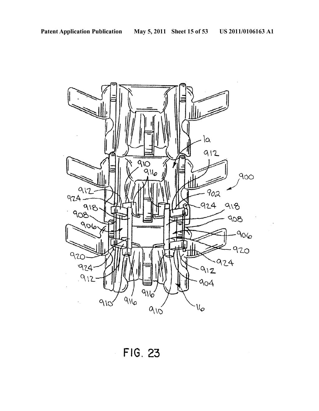 Interlaminar Stabilizing System - diagram, schematic, and image 16