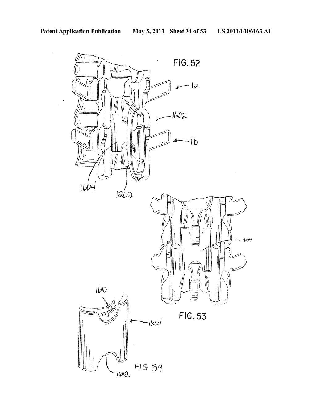 Interlaminar Stabilizing System - diagram, schematic, and image 35