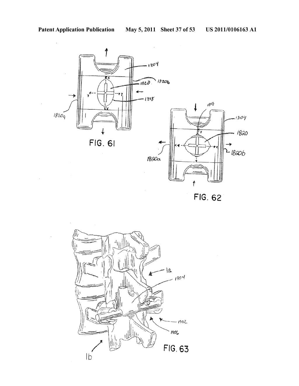 Interlaminar Stabilizing System - diagram, schematic, and image 38