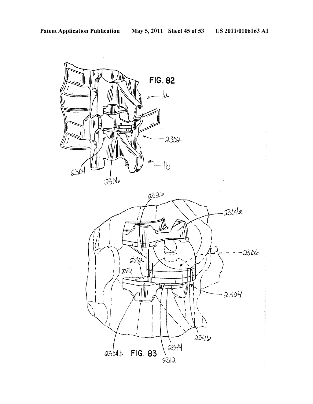 Interlaminar Stabilizing System - diagram, schematic, and image 46