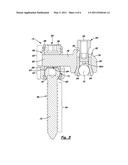 APPARATUS FOR IMPLEMENTING A SPINAL FIXATION SYSTEM WITH SUPPLEMENTAL FIXATION diagram and image