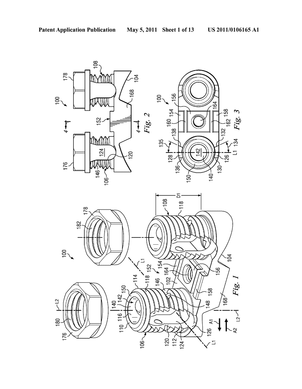 DEVICES AND METHODS FOR DYNAMIC SPINAL STABILIZATION AND CORRECTION OF SPINAL DEFORMITIES - diagram, schematic, and image 02