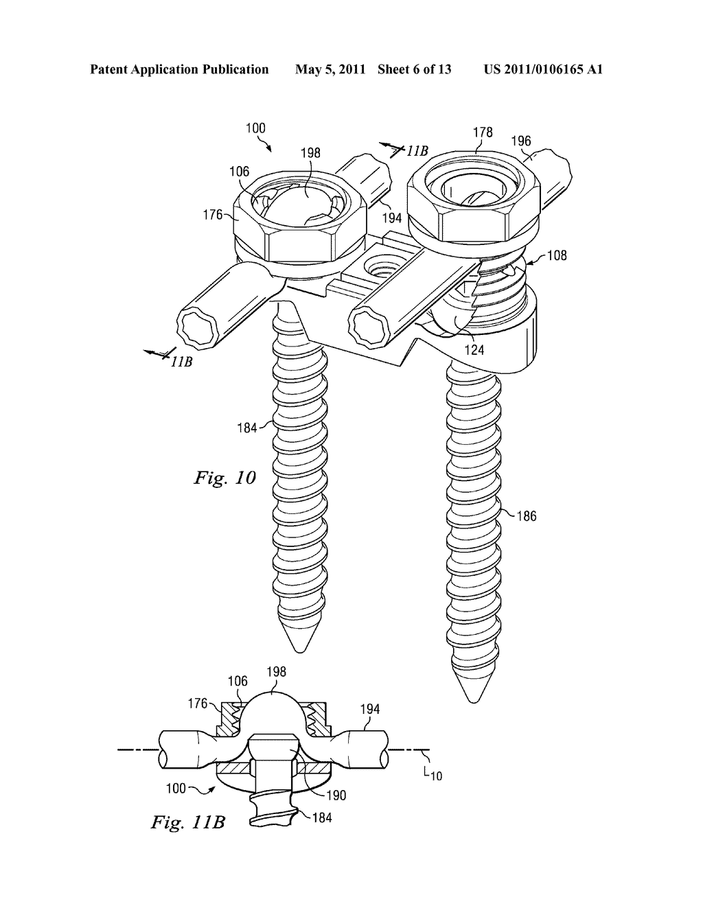 DEVICES AND METHODS FOR DYNAMIC SPINAL STABILIZATION AND CORRECTION OF SPINAL DEFORMITIES - diagram, schematic, and image 07