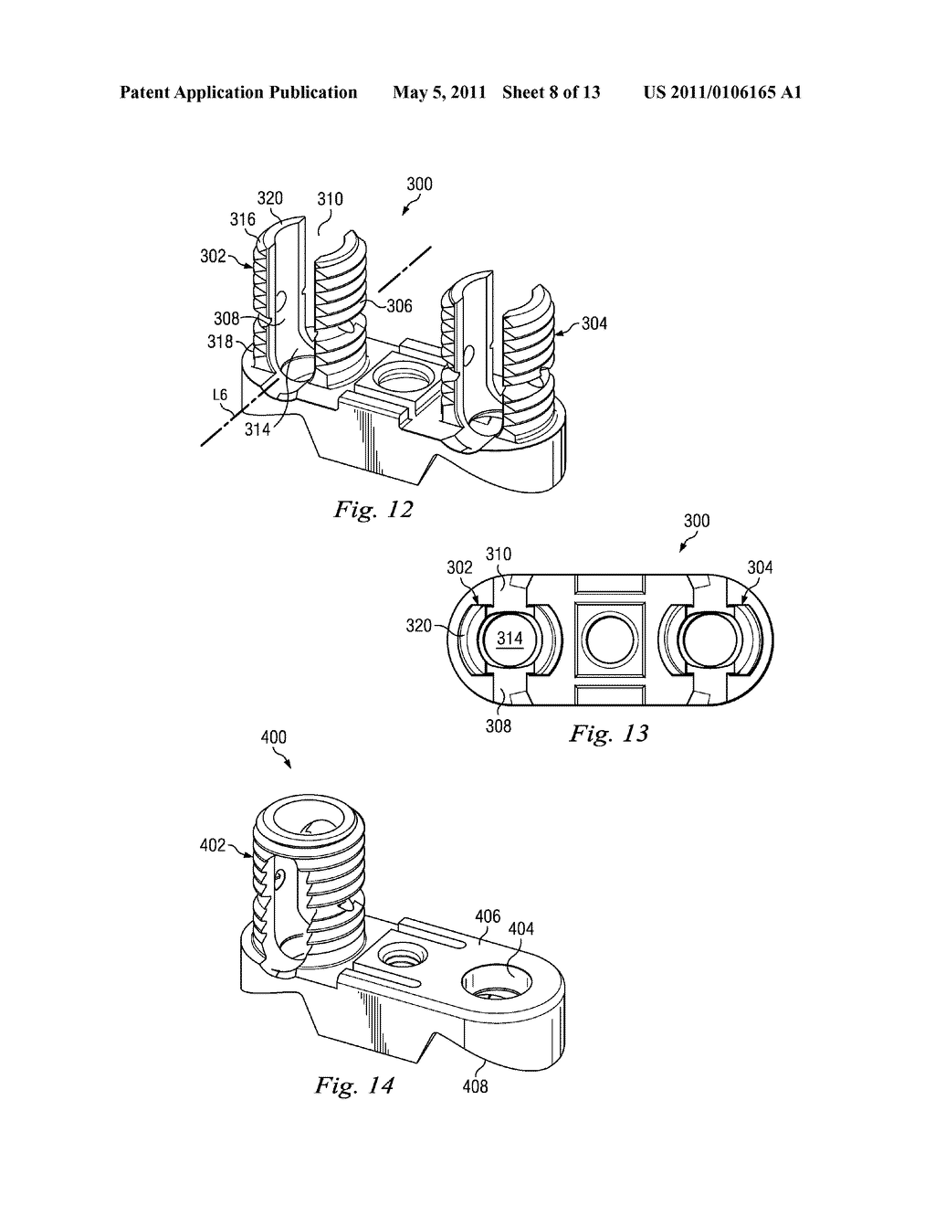 DEVICES AND METHODS FOR DYNAMIC SPINAL STABILIZATION AND CORRECTION OF SPINAL DEFORMITIES - diagram, schematic, and image 09