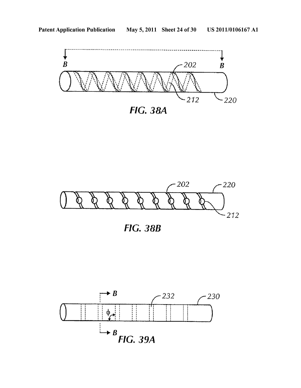 ADJUSTABLE SPINAL STABILIZATION SYSTEM - diagram, schematic, and image 25