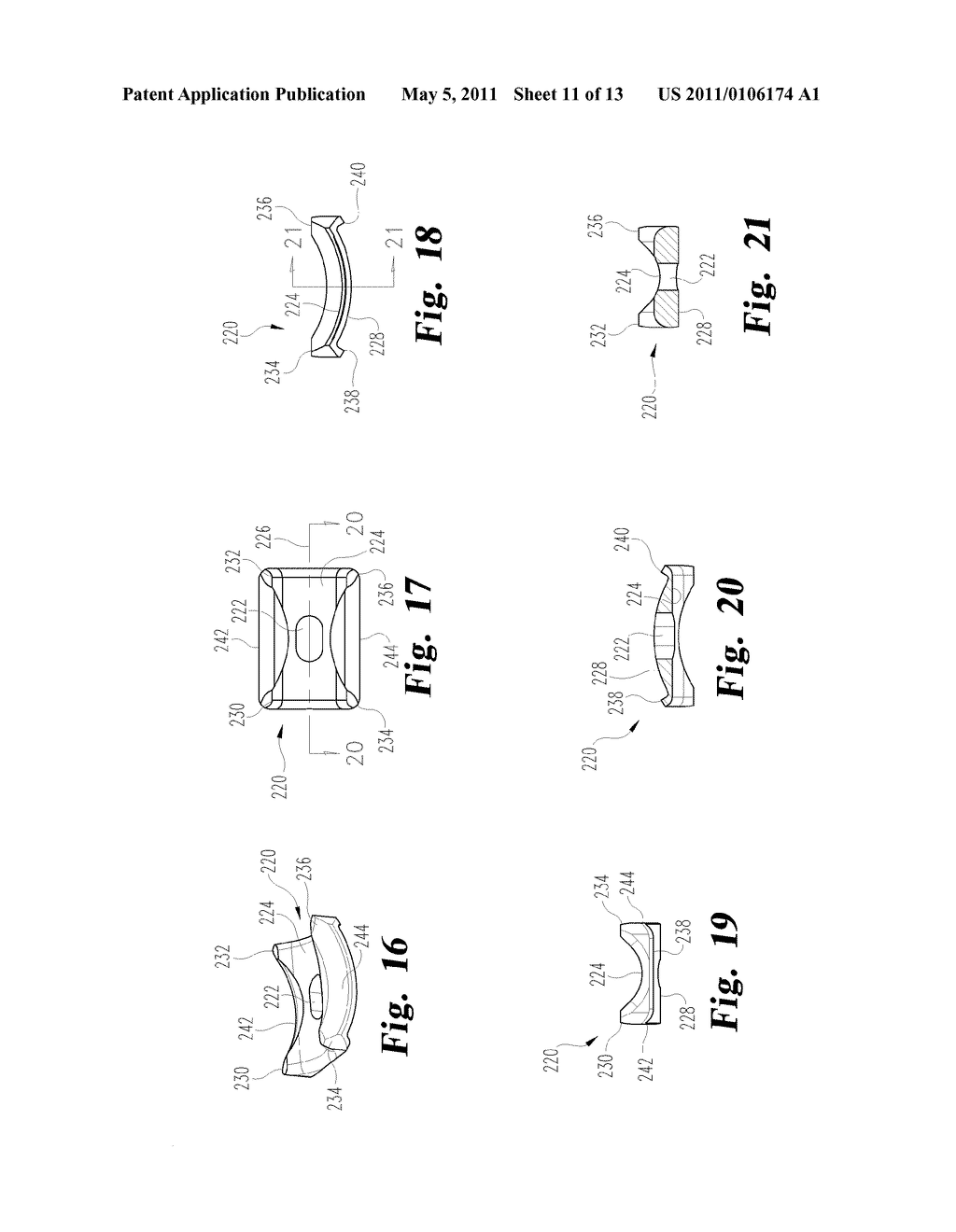 Direct Control Spinal Implant - diagram, schematic, and image 12