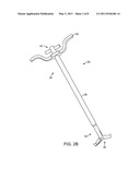 BONE FRAGMENT EXTRACTION diagram and image