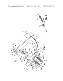 Instruments and methods for stabilization of bony structures diagram and image