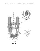 Instruments and methods for stabilization of bony structures diagram and image