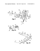 Instruments and methods for stabilization of bony structures diagram and image