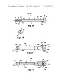 Instruments and methods for stabilization of bony structures diagram and image