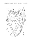 Instruments and methods for stabilization of bony structures diagram and image