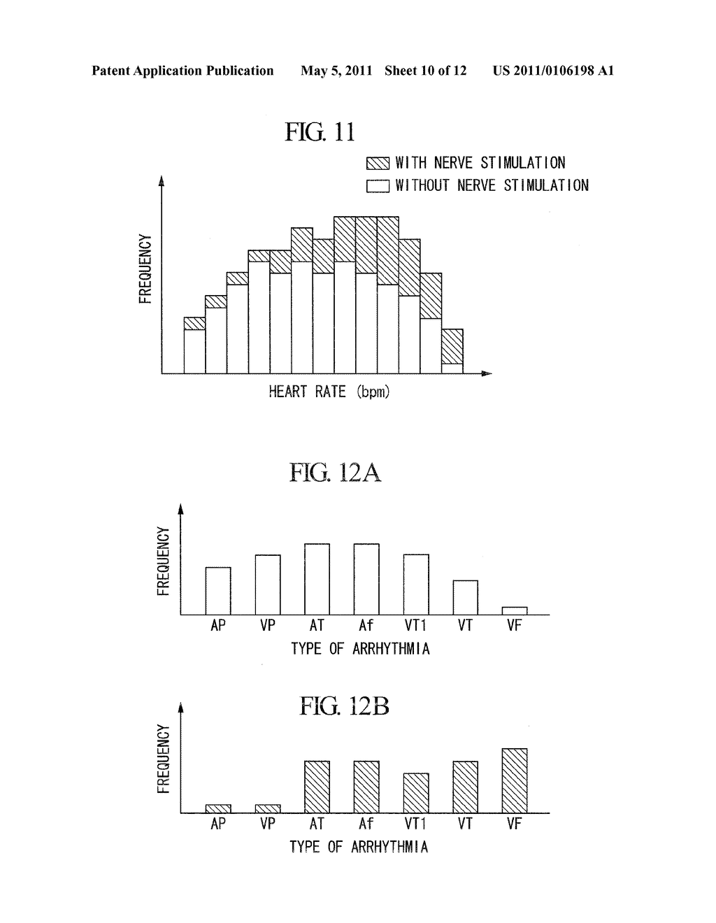 CARDIAC-EVENT PROCESSOR AND HEART TREATMENT DEVICE - diagram, schematic, and image 11