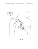 CONFIGURING OPERATING PARAMETERS OF A MEDICAL DEVICE BASED ON A TYPE OF SOURCE OF A DISRUPTIVE ENERGY FIELD diagram and image