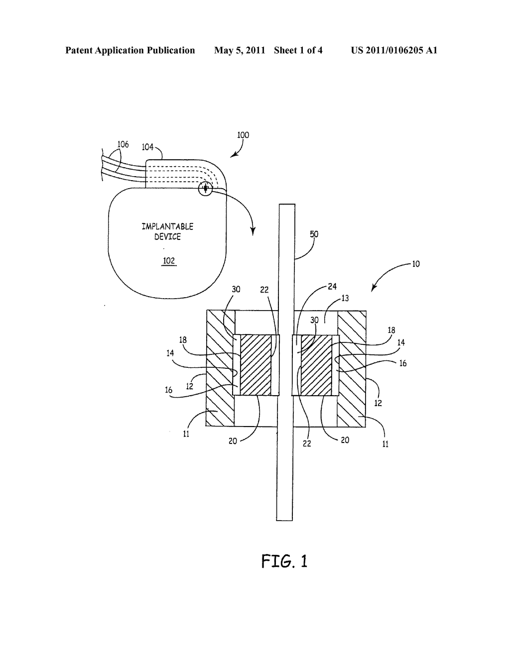 CERAMIC COMPONENTS FOR BRAZED FEEDTHROUGHS USED IN IMPLANTABLE MEDICAL DEVICES - diagram, schematic, and image 02