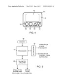 SYSTEM AND METHOD FOR MAPPING ARBITRARY ELECTRIC FIELDS TO PRE-EXISTING LEAD ELECTRODES diagram and image