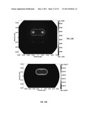 TREATMENT PLANNING FOR ELECTROPORATION-BASED THERAPIES diagram and image