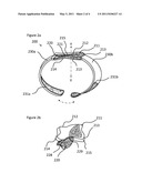 Therapeutic braceletand wrap diagram and image