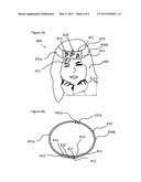 Therapeutic braceletand wrap diagram and image