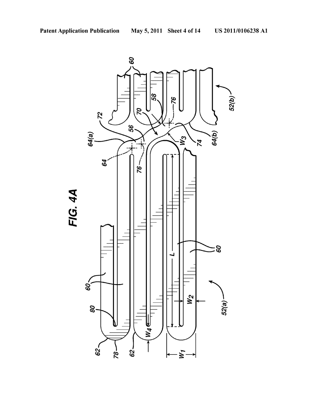 INTRALUMINAL DEVICE WITH IMPROVED FLEXIBILITY AND DURABILITY - diagram, schematic, and image 05