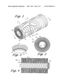 LARGE VESSEL STENTS AND OCCLUDERS diagram and image