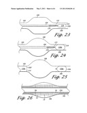 LARGE VESSEL STENTS AND OCCLUDERS diagram and image