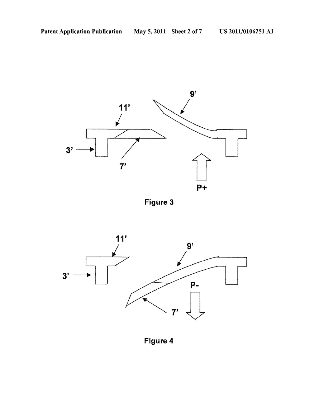 VALVE DEVICE INTENDED FOR BEING IMPLANTED IN A DYSFUNCTIONAL LARYNX OR A LARYNX PROSTHESIS - diagram, schematic, and image 03