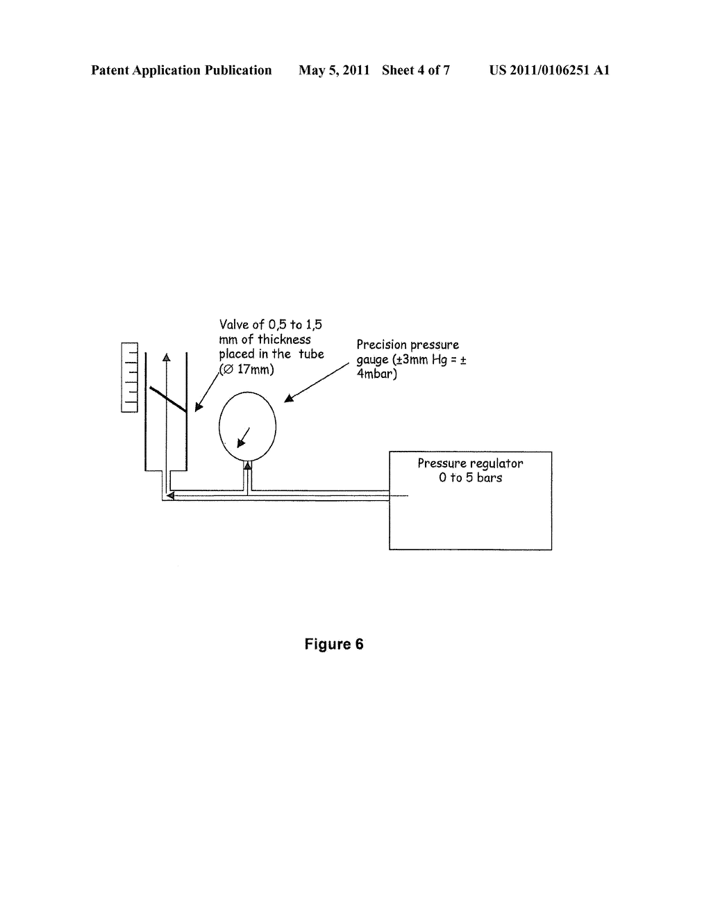 VALVE DEVICE INTENDED FOR BEING IMPLANTED IN A DYSFUNCTIONAL LARYNX OR A LARYNX PROSTHESIS - diagram, schematic, and image 05