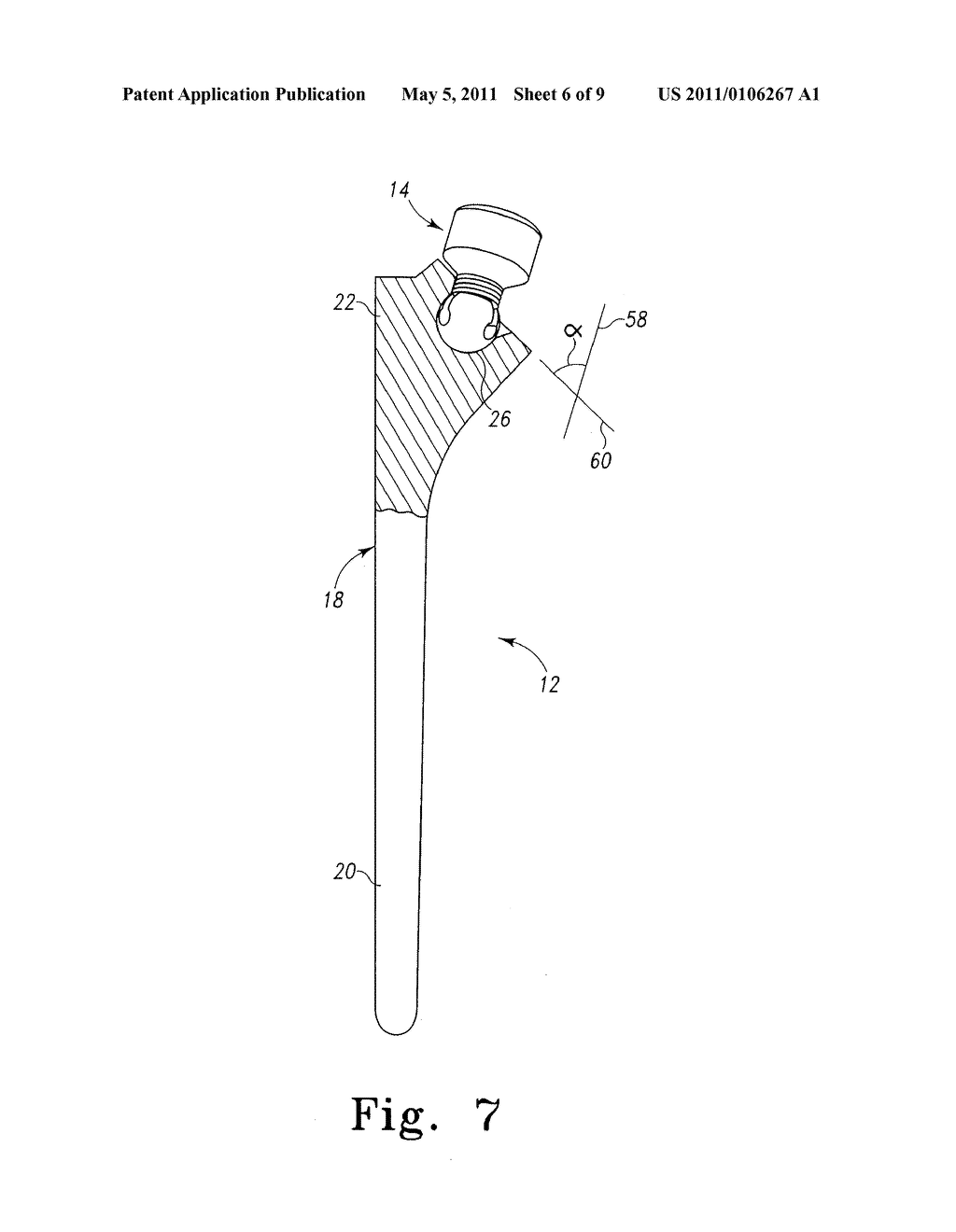 SHOULDER PROSTHESIS ADJUSTABLE HUMERAL HEAD MECHANISM - diagram, schematic, and image 07