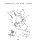 GASTROINTESTINAL PROSTHESES HAVING PARTIAL BYPASS CONFIGURATIONS diagram and image