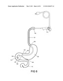 GASTROINTESTINAL PROSTHESES HAVING PARTIAL BYPASS CONFIGURATIONS diagram and image