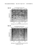 APPARATUS AND METHOD FOR CONVERTING AN AUDIOSIGNAL INTO A PARAMETERIZED REPRESENTATION, APPARATUS AND METHOD FOR MODIFYING A PARAMETERIZED REPRESENTATION, APPARATUS AND METHOD FOR SYNTHESIZING A PARAMETERIZED REPRESENTATION OF AN AUDIO SIGNAL diagram and image