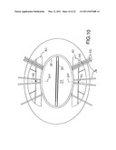 SELF-SUPPORTING PIER FOR A RETRACTABLE ROOF SYSTEM FOR A LARGE BUILDING STRUCTURE diagram and image