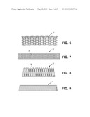 OCCLUSION IMPLANT diagram and image