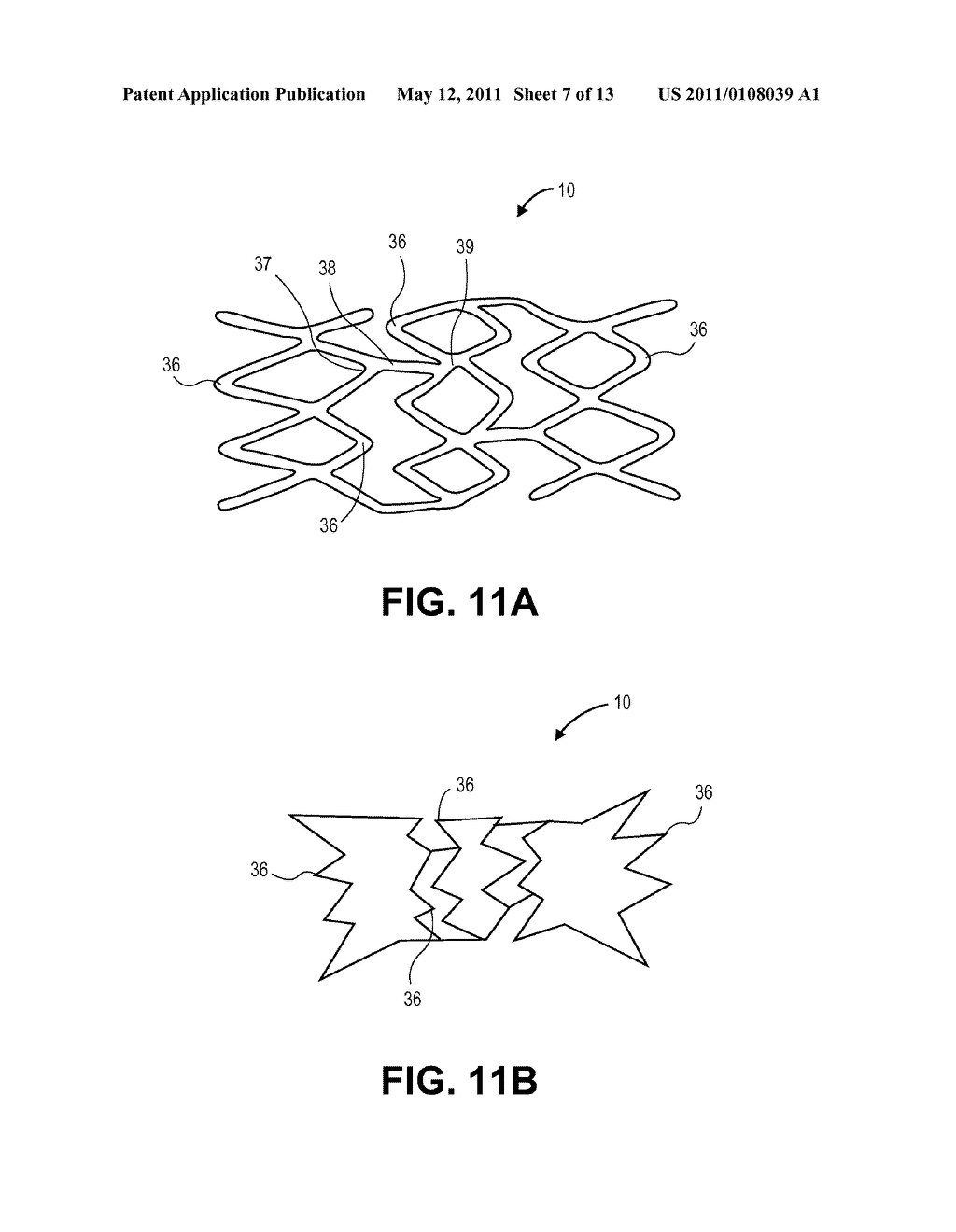 OCCLUSION IMPLANT - diagram, schematic, and image 08