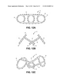 OCCLUSION IMPLANT diagram and image