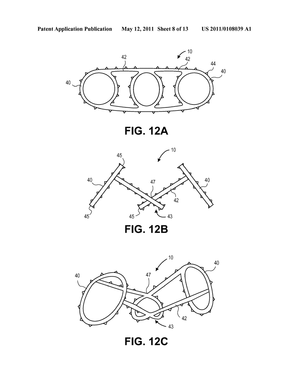 OCCLUSION IMPLANT - diagram, schematic, and image 09