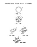 OCCLUSION IMPLANT diagram and image