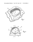 Lateral Support Craniocervical Orthosis and Method diagram and image