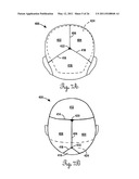 Lateral Support Craniocervical Orthosis and Method diagram and image