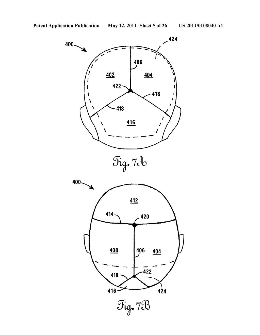 Lateral Support Craniocervical Orthosis and Method - diagram, schematic, and image 06