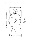 Lateral Support Craniocervical Orthosis and Method diagram and image