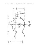 Lateral Support Craniocervical Orthosis and Method diagram and image