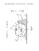 Lateral Support Craniocervical Orthosis and Method diagram and image