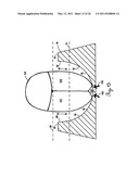 Lateral Support Craniocervical Orthosis and Method diagram and image