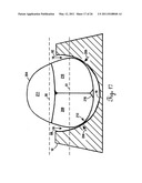 Lateral Support Craniocervical Orthosis and Method diagram and image