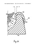 Lateral Support Craniocervical Orthosis and Method diagram and image