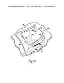 Lateral Support Craniocervical Orthosis and Method diagram and image