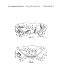 ONE-WAY CLUTCH RETAINER diagram and image